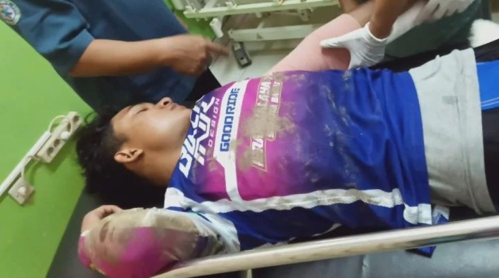 Aldo Bilkis Cedera Karena Gagal Mendarat